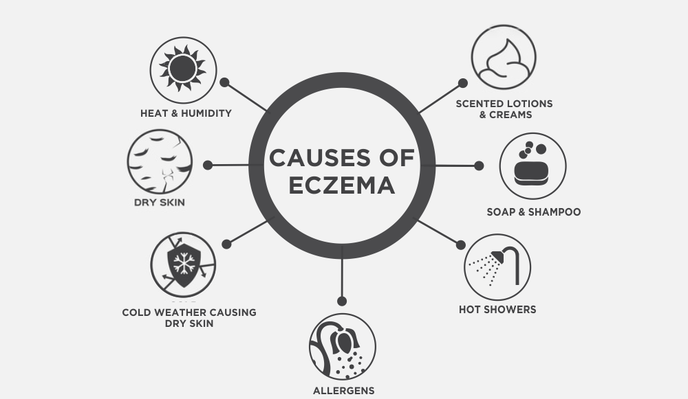 causes of eczema